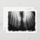 Carte Postale X-Ray Pieds humains Skeleton Bones noir et blanc (Devant / Derrière)