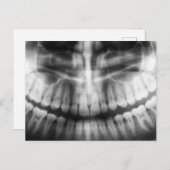 Carte Postale X-Ray Teeth Bouche sourire noir et blanc (Devant / Derrière)