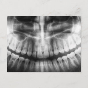 Carte Postale X-Ray Teeth Bouche sourire noir et blanc