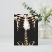 CARTE POSTALE XRAY SKELETON TORSO RIBS SEPIA (Debout devant)