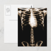 CARTE POSTALE XRAY SKELETON TORSO RIBS SEPIA (Devant / Derrière)