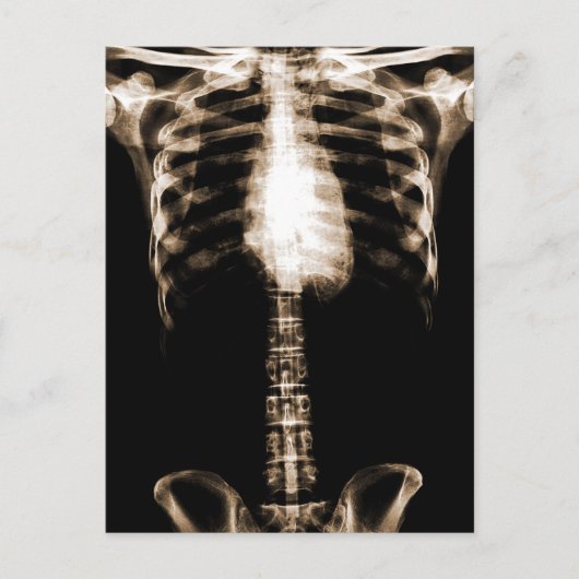 CARTE POSTALE XRAY SKELETON TORSO RIBS SEPIA (Devant)