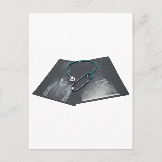 Carte Postale XRayConsult061209 (Devant)