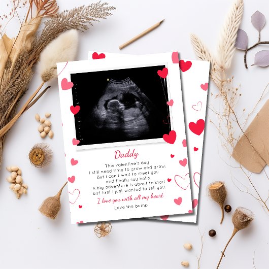 Carte Valentines à papa de bosse