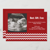 Cartes de Noël de grossesse Ultrasons (Devant / Derrière)