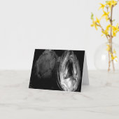 Cartes de notes d'artichaut - Noir et Blanc (Fleur jaune)