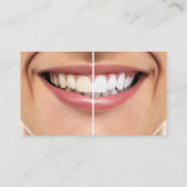 Cartes de rendez-vous pour blanchir les dents dent (Dos)