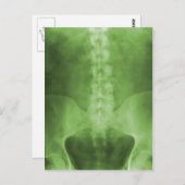 Cartes postales Digital X-Ray Art Vert (Devant / Derrière)