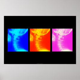 Cervicale röntgenfoto's poster 1