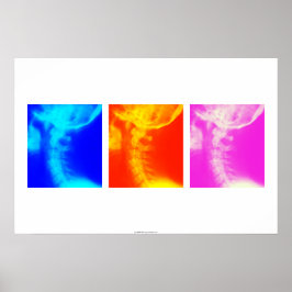 Cervicale röntgenfoto's poster 2