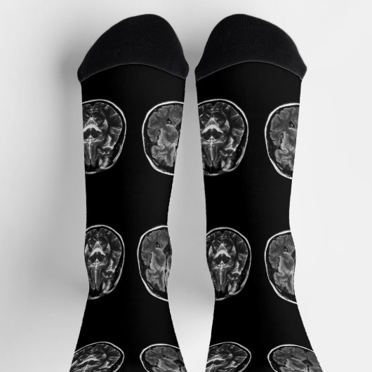 Chaussette Analyse Mri du cerveau (Haut)