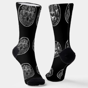 Chaussette Analyse Mri du cerveau