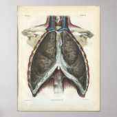 Chest Lung Anatomy Print (Voorkant)