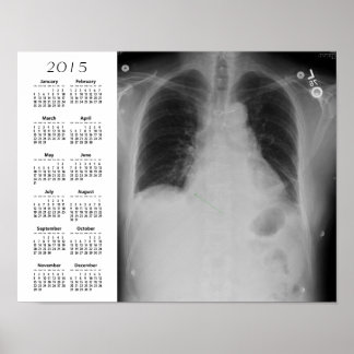 Chest X Ray agenda ~ Poster