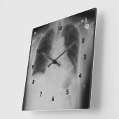 Chest X Ray ~ Clock Vierkante Klok (Hoek)