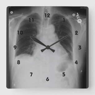 Chest X Ray ~ Clock Vierkante Klok