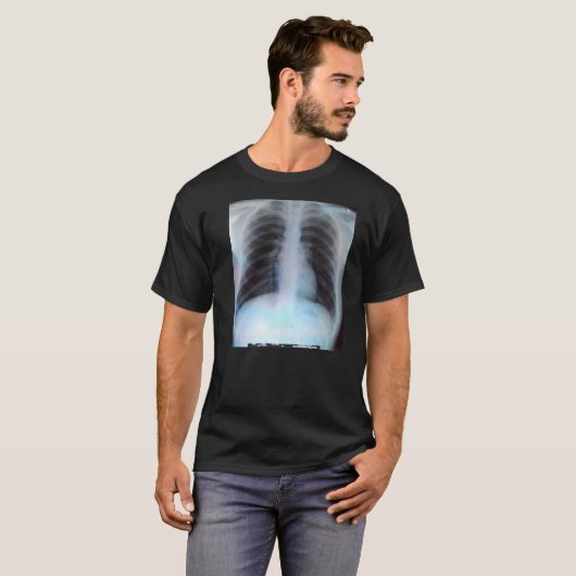 Chest X Ray T-Shirt (Voorkant volledig)