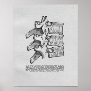 Chiropractische subluxe afdruk poster