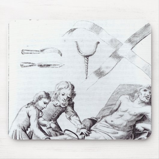 Chirurgische ingreep om een been te amputeren muismat (Voorkant)