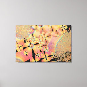 Cholesterolkristallen 2 canvas afdruk