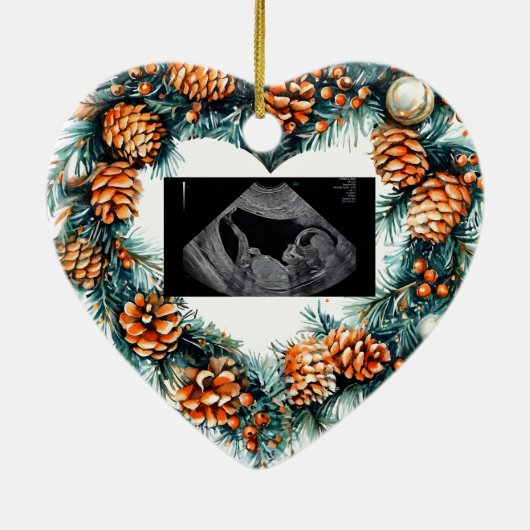 Christmas Pregnancy Ultrasound Baby On The Way Keramisch Ornament (Achterkant)