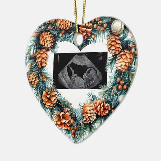 Christmas Pregnancy Ultrasound Baby On The Way Keramisch Ornament (Links)