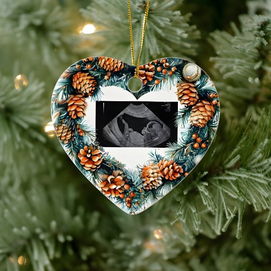Christmas Pregnancy Ultrasound Baby On The Way Keramisch Ornament