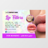 Clik voor venster Lipvullingservices Raamsticker (Vel)