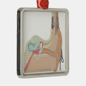 Cochlear Implantaten Metalen Ornament (Rechts)