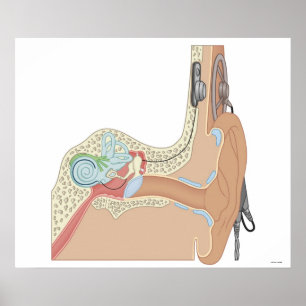 Cochlear Implantaten Poster