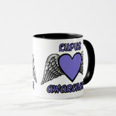 Coeur/ailes...Lupus Mug (Devant droit)