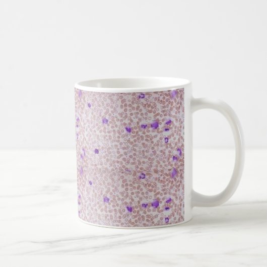 Coffee Mok - Chronische myeloïde leukemie (CML) (Rechts)