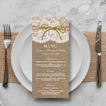 Collection de Mariages Rustic Twine Bow - Menu<br><div class="desc">La collection rustique de mariage arc-en-cercle est un design époustouflant avec un joli arrière - plan rustique effet burlap avec une finition romantique vintage effet dentelle blanche a fini un ruban de ficelle et arc. Ces cartes de menu peuvent être personnalisées pour votre occasion spéciale et feraient le menu parfait...</div>