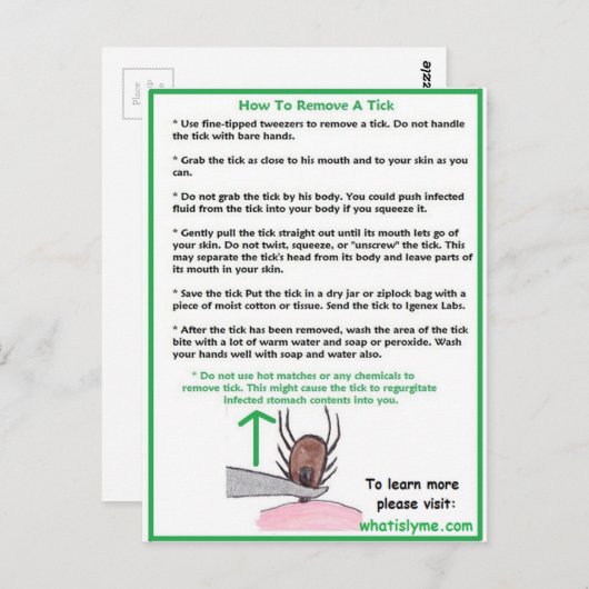 Comment retirer une carte d'instructions de frappe (Devant / Derrière)