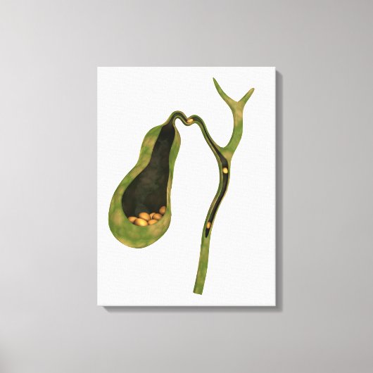 Conceptueel Afbeelding van galstenen in galgen Canvas Afdruk (Voorkant)