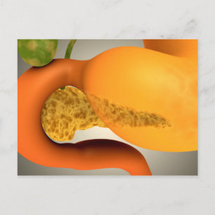 Conceptueel Afbeelding van menselijke pancreas en  Briefkaart
