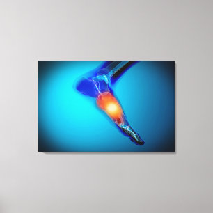 Conceptueel Afbeelding van pijn bij de mens Canvas Afdruk