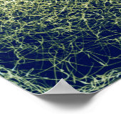 CONGESTISCHE OGEN voor Mal Poster (Hoek)