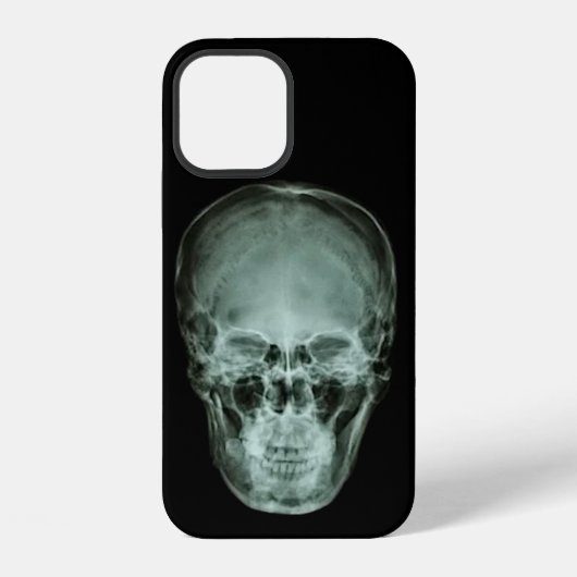 Coque iPhone 12 Radiographie du crâne (Verso)