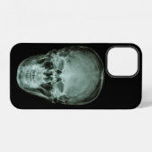 Coque iPhone 12 X-Ray crâne (Verso Horizontal)