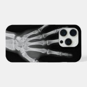 Coque iPhone 15 pro squelette (Verso Horizontal)