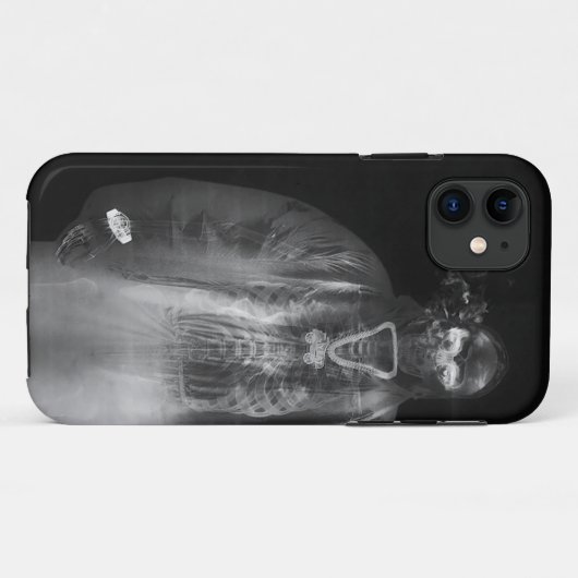 coque iphone de couverture de l'album yeat after l (Dos (Horizontal))