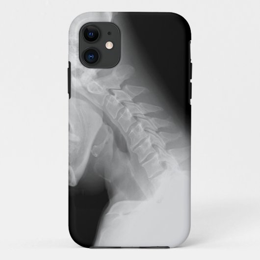 Coque iphone de rayon de mâchoire et d'épine X (Dos)