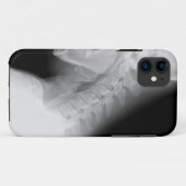 Coque iphone de rayon de mâchoire et d'épine X (Dos (Horizontal))