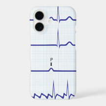 Coque iphone d'ECG/EKG