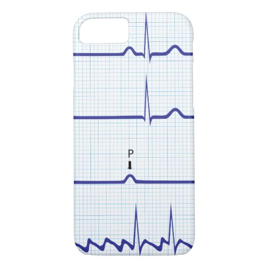 Coque iphone d'ECG/EKG (Dos)