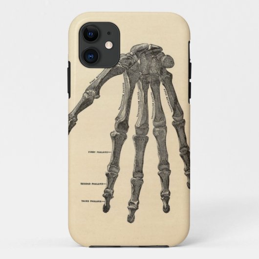 Coque iphone Médicale d'os de main d'anatomie (Dos)