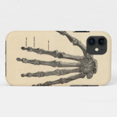 Coque iphone Médicale d'os de main d'anatomie (Dos (Horizontal))