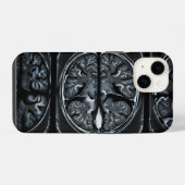 Coque Pour iPhone 14 IRM cérébrale (Verso Horizontal)