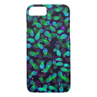 Case-Mate iPhone Case Aluminium